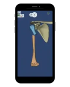 Bone Fractures